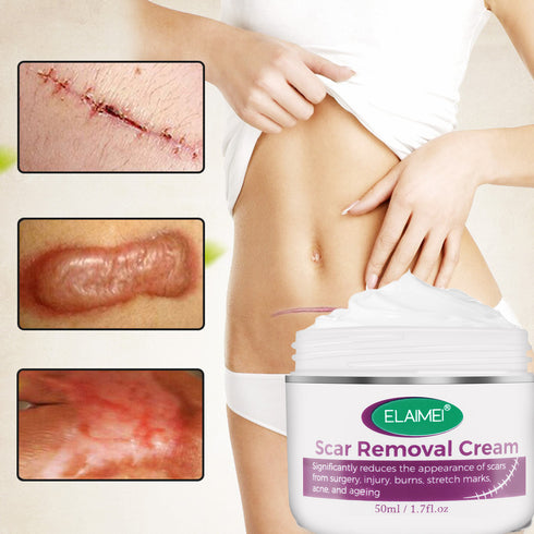 Skin Rebound Scarless Cream Scar Removal Cream Face Cream For Face Acne Scar Stretch Marks Skin Repair Face Cream - ROUTINE FASHION